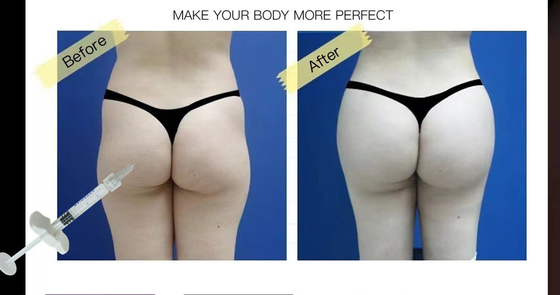 Subskin SubQ Injectable Hyaluronic Acid Breast Filler Untuk Pembesaran Penis Pantat