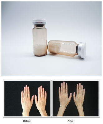 Hyaluronic Acid Dermal Filler Injectable Gel Memungkinkan Pengelompokan Wajah yang Tepat dan Tekstur Kulit Lemes untuk Profesional