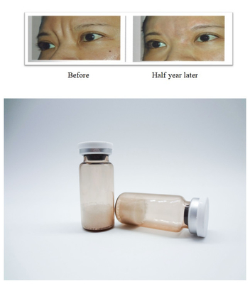 PLLA Poly-L-Lactic Acid Dermal Filler Injeksi Menghilangkan Kerutan Wajah Menggugah Regenerasi Kolagen