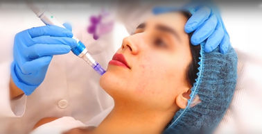 20mg / Ml Non Cross Linked HA Dermal Filler Anti-Aging Ha Untuk Pena Hyaluron