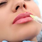 Bentuk Gel Pengisi Bibir Suntik 24mg / Ml Asam Hyaluronic Alami