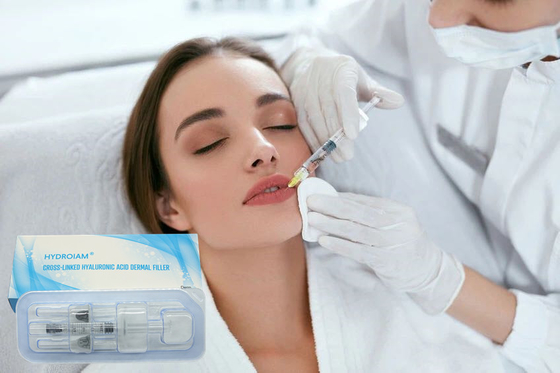 Augmentation Hyaluronic Acid Lip Suntikan Bibir Tampak Gemuk Alami