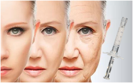 Produk Injeksi Asam Hyaluronic Berbasis Pcl Serum Miracle Touch Up Skin