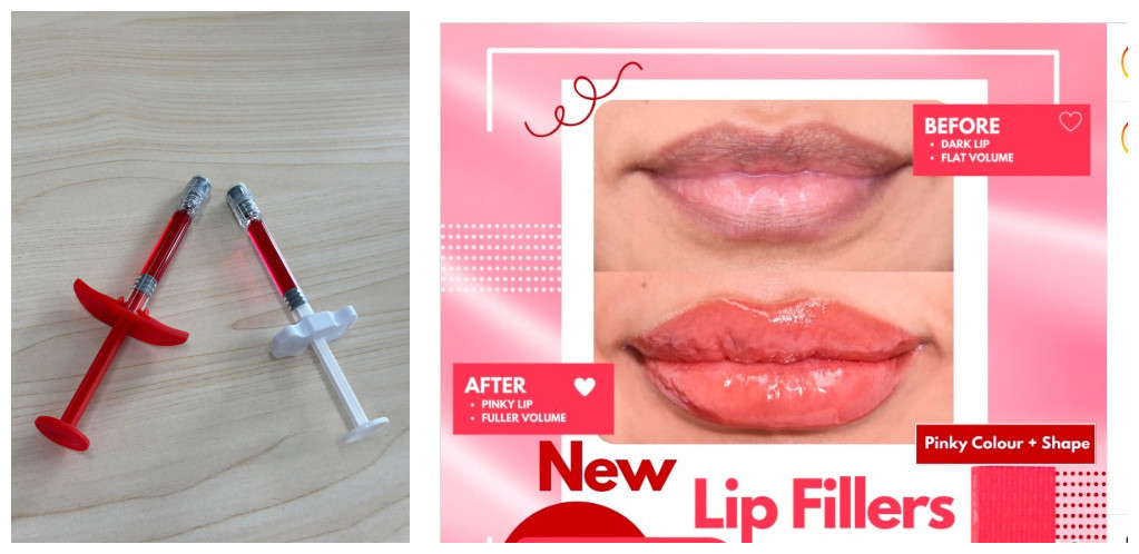 Filler Bibir Kulit Aman dan Efektif untuk Profesional Kedokteran