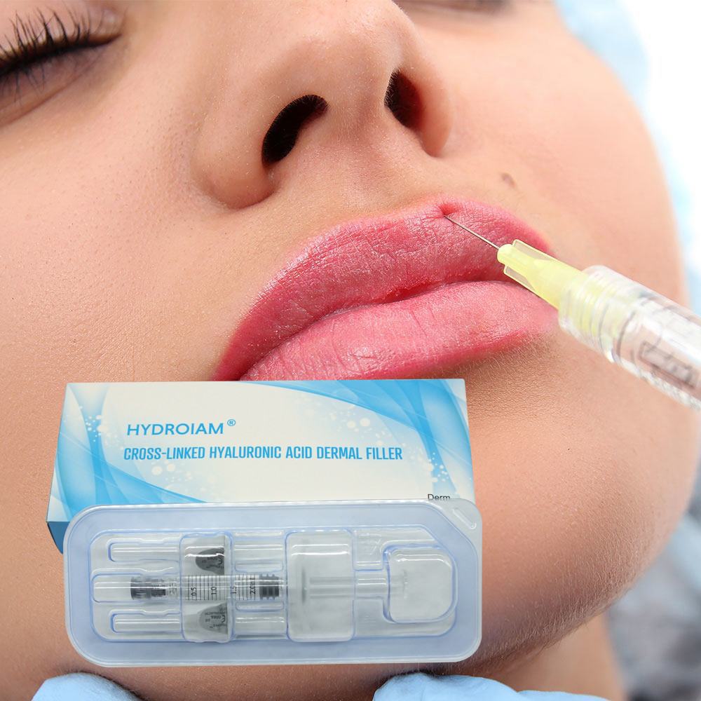 1ml 2mL Deep Ha Filler Payudara Ha Dermal Filler Untuk Bibir Sertifikasi CE