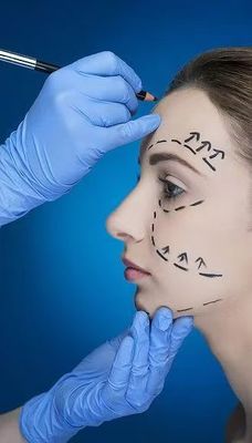 Lemparan halus dan Jawline yang jelas Dengan Pengisi Kulit Wajah 70% HA Cross Linked 24mg 30% Kalsium Hydroxylapatite